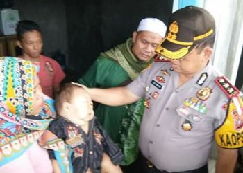 Kapolres Pelabuhan Belawan Kunjungi Balita Penderita Kelainan Ginjal