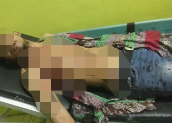 Sopir Grab di Binjai Dirampok dan Dilukai Penumpangnya