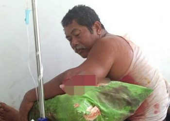 Pria Paruh Baya di Muna Ditebas Keponakan Sendiri, Lengannya Nyaris Putus