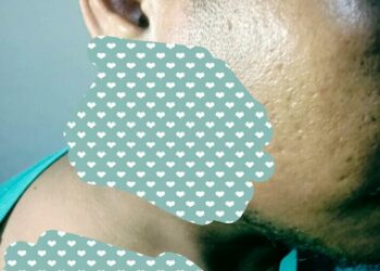 Polsek Bone Muna Tangani Pelaku Penganiayaan Warga Desa Matombura