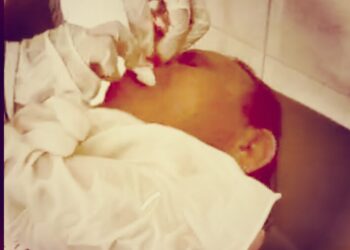 Sadis, Tokoh Adat Bombonawulu Dibabak Belur Hingga Bersimbah Darah