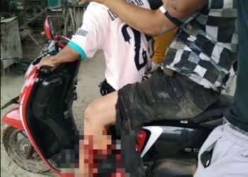 Lagi-lagi Kecelakaan Kerja Terjadi di Perusahaan Mega Industry PT OSS