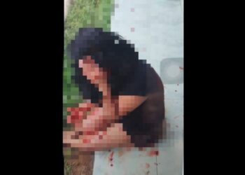 Wanita di Kendari Dianiaya Mantan Suami Pakai Parang, Ini Penyebabnya
