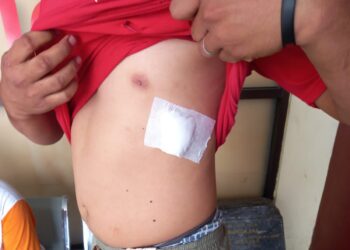 Otong Kena Tikam Gara-gara Bantu Teman