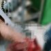 Telapak Tangan Mirda, Warga Kassilampe Hancur Terkena Petasan Rakitan