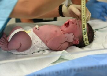 Ini Enam Peyebab Hidrosefalus, Segeralah ke Dokter Berobat